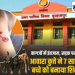 नगर निगम के पास ही 7 साल के बच्चे को कुत्ते ने काटा: नसबंदी-शेल्टर के दावों के बीच सड़कों पर खौफ बुरहानपुर में आवारा कुत्ते के हमले में घायल 7 वर्षीय बच्चा