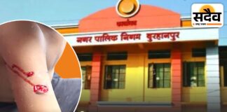 नगर निगम के पास ही 7 साल के बच्चे को कुत्ते ने काटा: नसबंदी-शेल्टर के दावों के बीच सड़कों पर खौफ बुरहानपुर में आवारा कुत्ते के हमले में घायल 7 वर्षीय बच्चा